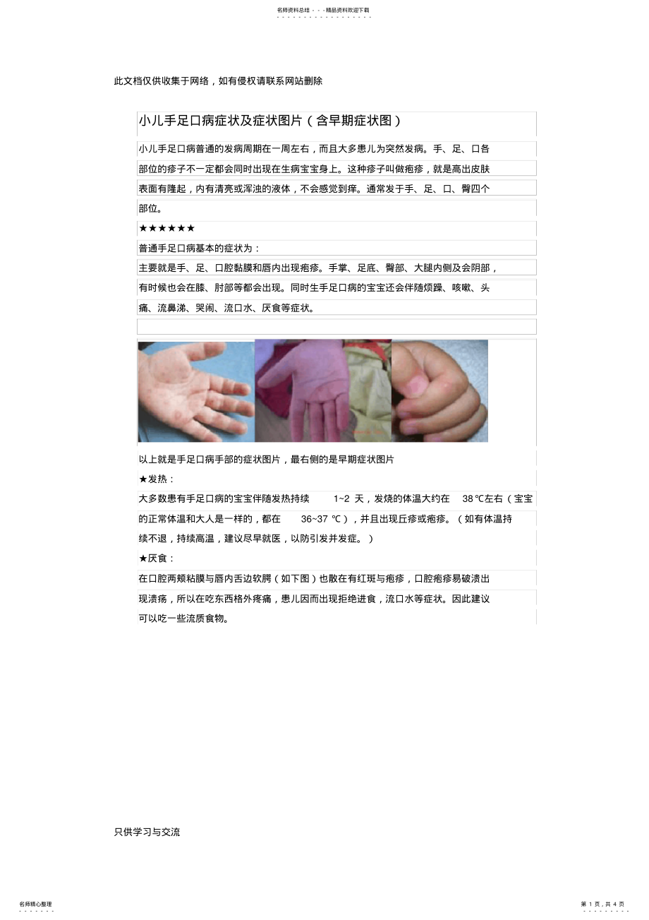 2022年小儿手足口病症状及症状图片说课讲解 .pdf_第1页