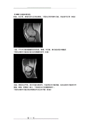 半月板损伤的MRI分级(2页).doc